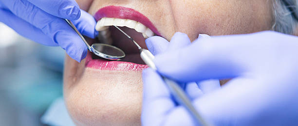 Best Emergency Dentist for Knocked-Out Tooth in Riverdale, NJ